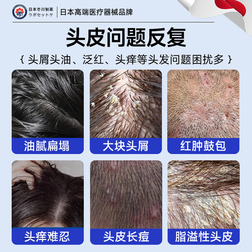 Jichuan Pharmaceutical Dankangwang Ketokang Hair Lotion Head Hair Follicle Seborrheic Dermatitis Special Anti-Dandruff Anti-Itching Oil Control Shampoo