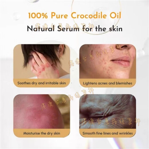 Shake Hand Brand Shake Hand Brand Alligator Oil Imported from Singapore Crocodile Oil Hua'an Pharmacy Fine Lines, Acne and Scar Repair 46ML-Large Bottle Singapore Alligator Oil Shake Hand Brand