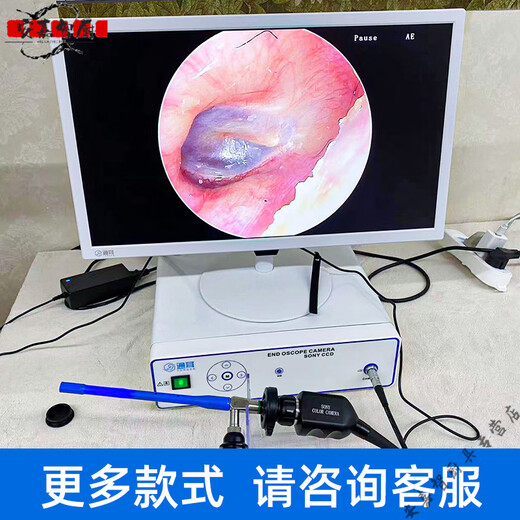 Yong Huan German quality professional visual ear picking instrument HD equipment ear picking shop special commercial ear picking tool ear picking host model GO1:21:5 inch display