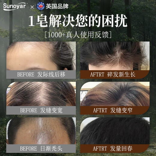 Sunoyar Usman Grass Shampoo Soap Platycladus Arborvitae Leaf Polygonum Multiflorum Shampoo, Strengthen Hair and Prevent Breakage Xinjiang Seven-Five Black Hair Care Non-Green Domestic Products