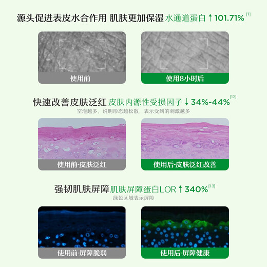 Songda Baby Camellia Oil Touch Oil Baby Body Moisturizing Oil Newborn Skin Care Massage Oil Hip Care Cream Removes Scalp Hot Selling Camellia Oil 50ml