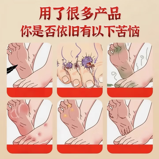 Hong Kong Pharmacy Fungus King 50g skin itching fungal infection athlete's foot and foot odor antibacterial and anti-itch cream for the inner thighs all over the body 50g in a bottle trial pack