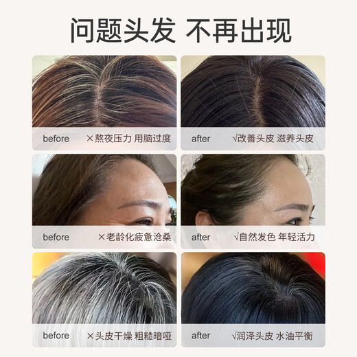 Sibiman domestic products, nearly 2,000 counters, hair care essence 100ml white hair nutrient solution to nourish hair, green hair