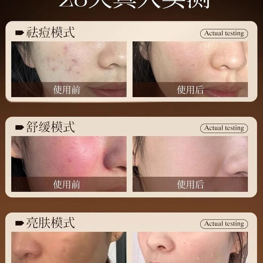 KONKA Mask Beauty Instrument Lighting and Brightening Artifact Home Repair Red, Yellow, and Blue Lighting Lamp Tail Cargo Machine Golden Skin Rejuvenation Light 4 Lights and 3 Modes Can be Matched at Your Desire to Soothe and Rejuvenate the Skin