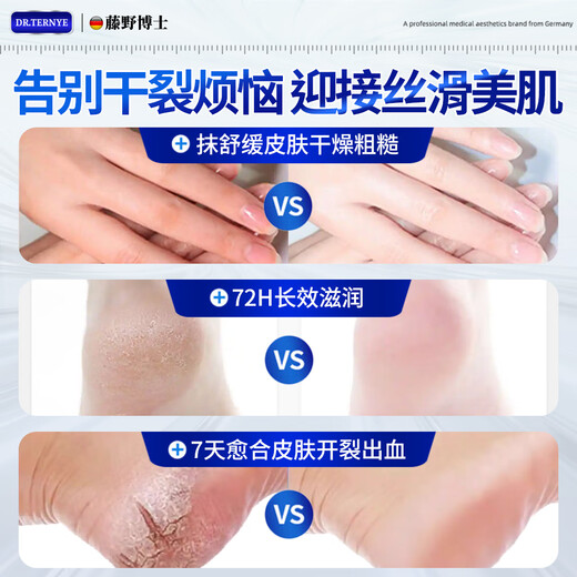 SIENORC Cracked Feet Cream for Cracked Heels, Cracked Heels, Cracked Heels, Cracked Heels, Foot Cream, Foot Cream 1 Box, Stay away from Cracked Hands and Feet on the same day