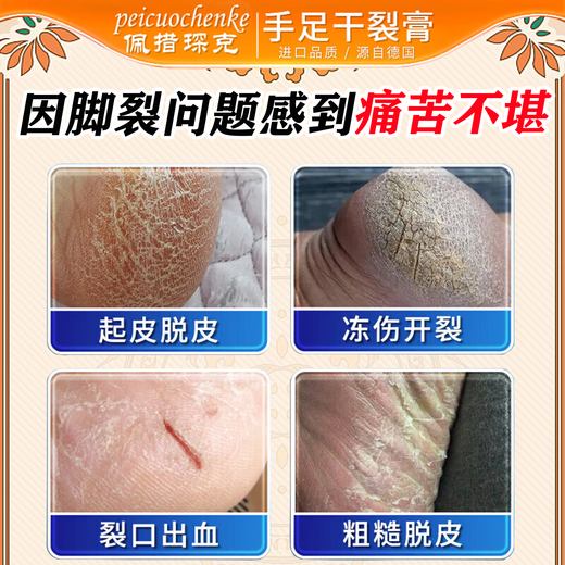 Petsochenke Cracked Foot Cream Anti-cracking Cream for Cracked and Cracked Heels, Cracked and Cracked Hands and Rough Skin, Self-Moisturizing Foot Cream in a Box, Powerful and Effective Healing Cream for Cracked Feet