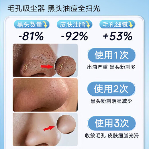 Xulin Beauty Salon Same Style丨Deeply Clean Skin German Blackhead Instrument Extra Large Suction Cleaner Electric Blackhead Suction and Acne Shrinking Pore Home Small Bubble Beauty Device Standard Fresh Style Deep Skin Cleansing Restores Moisturized Skin