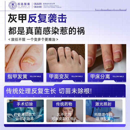Dr. Xin's onychomycosis special effect specializes in treating nail infection with yellowing and thickening root cream 30ml.