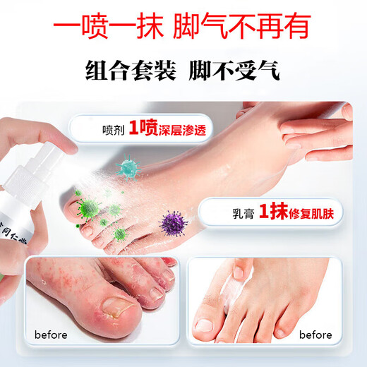 Tongrentang Athlete's Foot Spray Anti-itching Peeling Feet Sweat Blisters Itchy Feet Smelly Sweat Spray Wolfsbane Spray 60ml + Ointment 20g