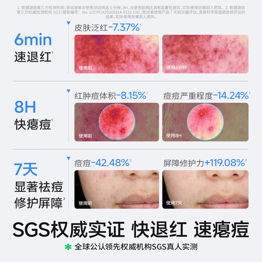 Turtle Dad Acne Anti-Acne Essence Second-Purpose First-Aid Acne Teenagers Oil Control Prevents Repeated Fading of Red Acne Marks 30ml