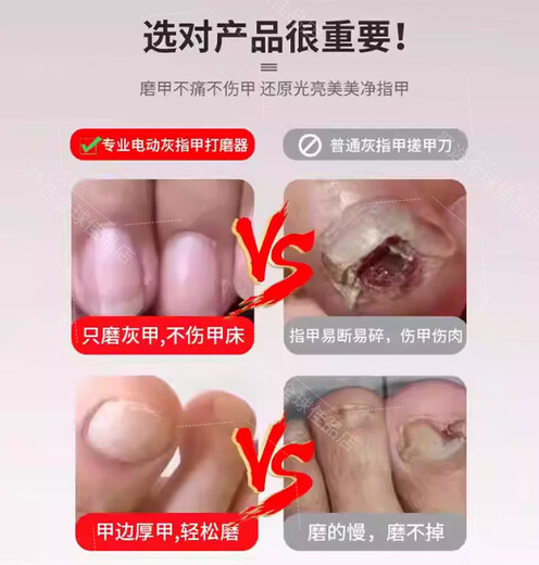 GERTHRON German Electric Nail Grinder for Adults and Elderly Onychomycosis Electric Nail Grinder Nail Scissors and Files for Pedicure German High-Quality Khaki Color (Easy to Cut Thick and Hard Onychomycosis) Genuine Guarantee Genuine 0 Cuts