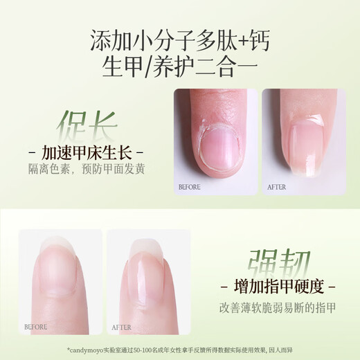 CandyMoyo finger edge oil anti-hangbnail soft dead skin nail polish nail thin soft care keratin manicure essence pen nutrient solution