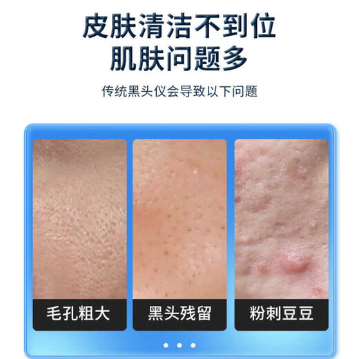 TRUVOER Germany small bubble blackhead instrument beauty salon special suction facial cleaning special acne acne suction device household blackhead cleaning artifact 2025 new upgraded small bubble blackhead instrument + 6 free probes German quality