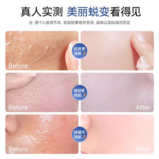 AUX hot spray facial steamer beauty instrument facial steamer steamer oxygen injector nano spray hydrating open pores home mask partner birthday New Year's Day gift