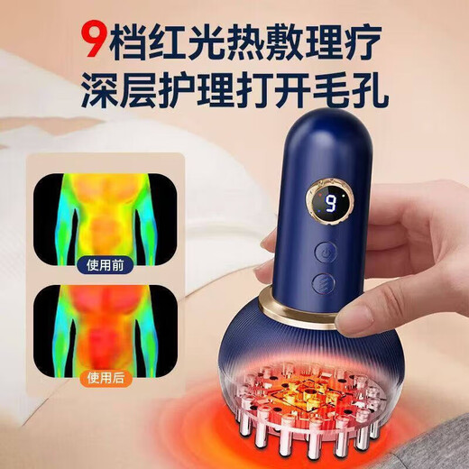 Sawang Germany electric scraping instrument, cupping all-in-one machine, cupping, walking cupping, hot compress, dredging of abdominal meridians, fully automatic walking cupping, unblocking cup, New Year's gift for parents, fully equipped with third generation Por white fixed cupping + walking cupping