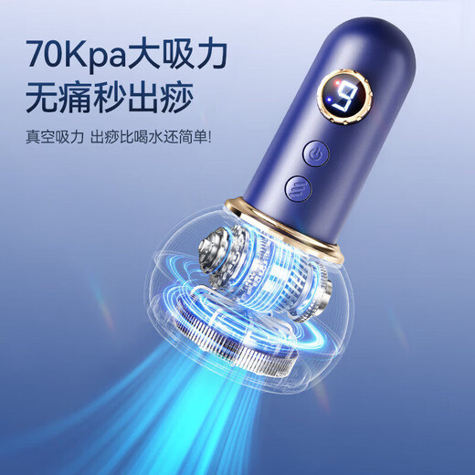 Sawang Germany electric scraping instrument, cupping all-in-one machine, cupping, walking cupping, hot compress, dredging of abdominal meridians, fully automatic walking cupping, unblocking cup, New Year's gift for parents, fully equipped with third generation Por white fixed cupping + walking cupping