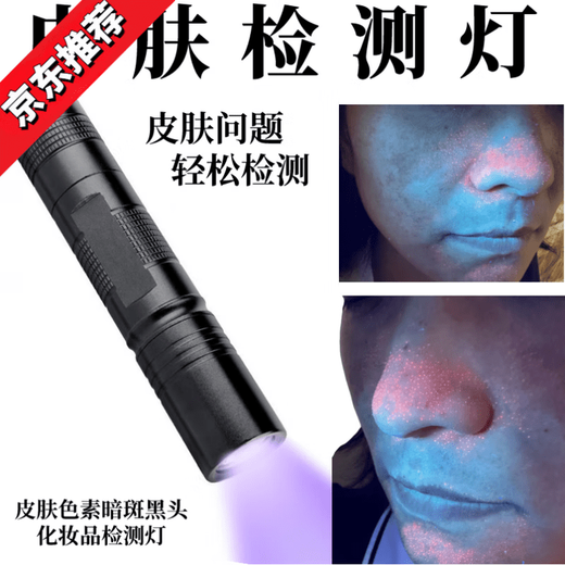 Skin detector, blackhead, acne and grease lamp, fungus and ringworm diagnosis, facial lighting, cosmetics, fluorescent flashlight, skin detection lamp, rechargeable 20W