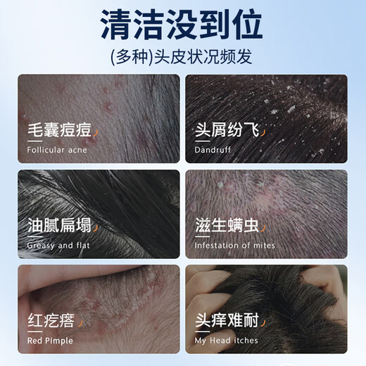 LEASCAN二硫化硒洗发水500ml去屑止痒洗剂控油蓬松清爽毛囊清洁液洗发露