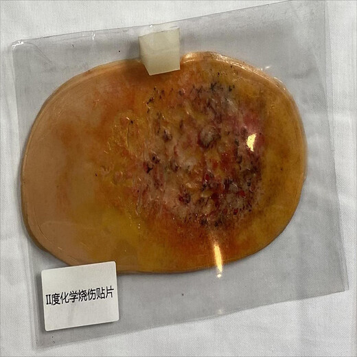 JUNCUS injury presentation simulation equipment JC-F103X
