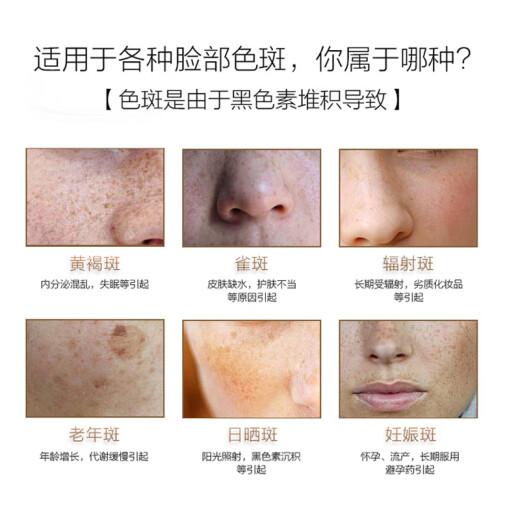 Tongrentang Whitening Freckle Cream 45g Night Repair Spot Lightening Product Freckles Chloasma Pregnancy Spots Sunspots Age Spots