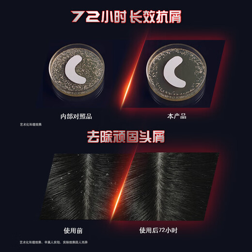 清扬（CLEAR）男士劲能瓶头皮劲活专研抗屑止痒洗发露570gX2+100g*2
