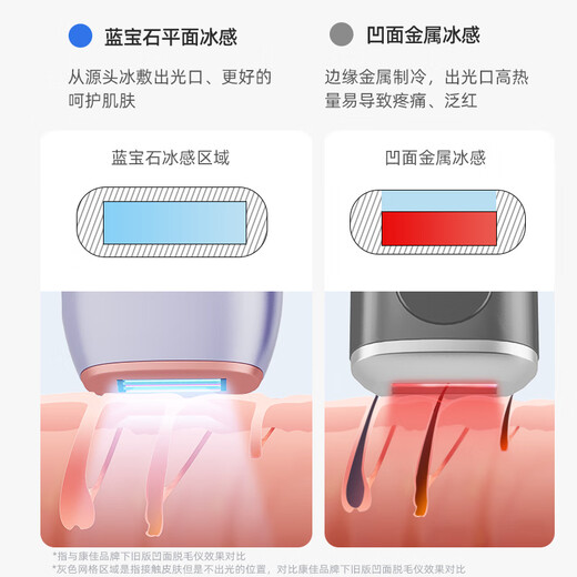 KONKA Hair Removal Device 3301 Sapphire Ice Feel Freezing Point Household Dormitory Hair Removal Machine for Lips, Armpits and Legs, Bikini Line, Practical Gift for Girlfriend’s Birthday, Guaranteed Price, Cream White - Quartz Crystal Freezing Point Version