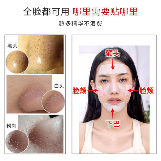 Ruwei (RNW) Double Moisturizing Blackhead Remover Nose Mask 2 Box Set Exports Essence Pig Nose Strawberry Nose Acne Shrinks Pores