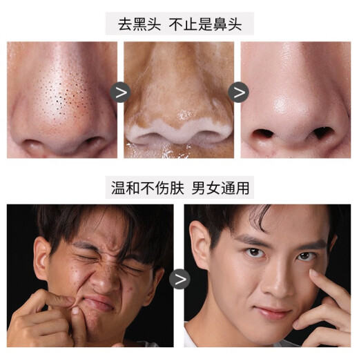 Baimiss Baimiss Qing Rong Ying Muscle Peel-off Blackhead Mask Gentle and clear, shrink pores, peel off blackheads, nose patch, facial cleansing men's and women's peel-off mask 50g