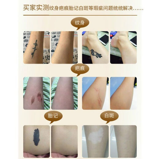 Jiefuquan covers tattoos, invisible and powerful flesh-colored stickers, professional birthmark covering, long-lasting waterproof breathable concealer, fake leather, light skin color, thick 15 cm wide * 2 meters long, roll high