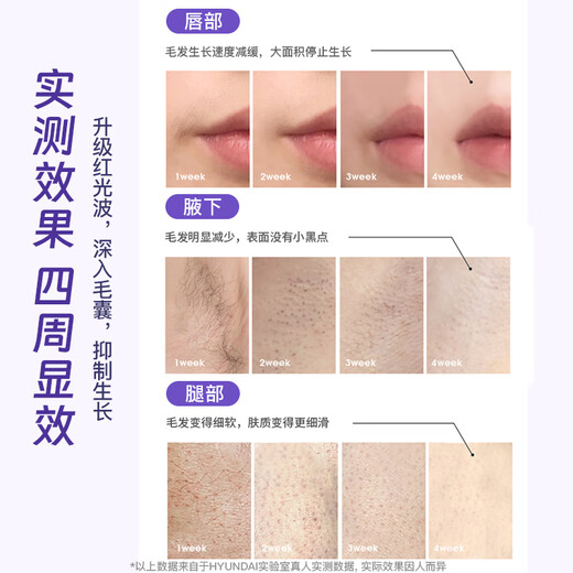 Luyao (LUYAO) Hair Removal Device Freezing Point Household Sapphire Ice Cream Private Part Light Shaving/Epilator is a high-end birthday gift for your girlfriend. Medical Luxury Edition + Extremely Fast Red Light + True Freezing Point + Root Removal and Growth Suppression