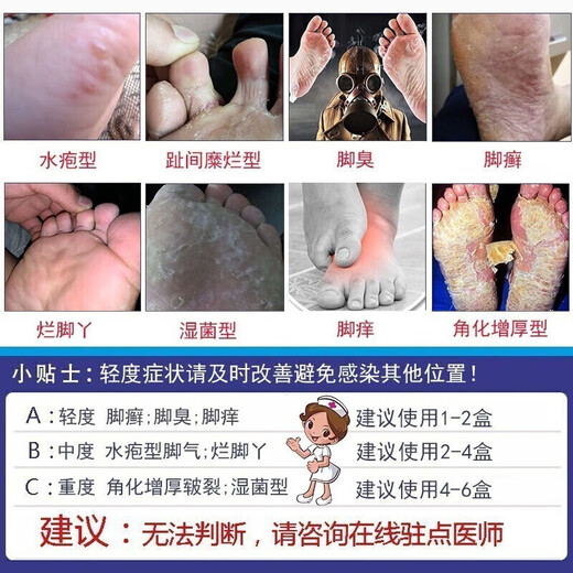Tongrentang Athlete's Foot Spray Anti-itching Peeling Feet Sweat Blisters Itchy Feet Smelly Sweat Spray Wolfsbane Spray 60ml + Ointment 20g