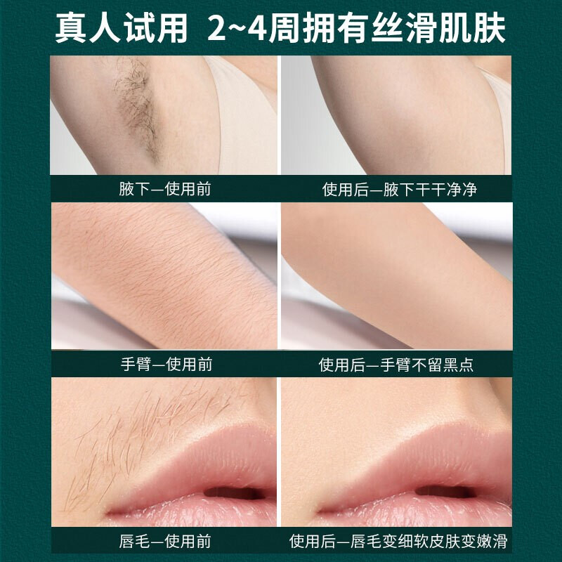 RIX Hair Removal Device Freezing Point Laser Hair Removal Home Use Facial Lip Armpit Leg Hair Private Part Hair Removal Device New Unisex Glazed White (350,000 Hair Freezing Point Ice Feel + Firming and Rejuvenation)