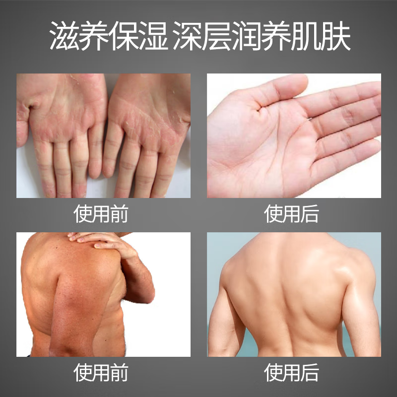 Sakose Vaseline men's fruit acid moisturizing body lotion 500ml autumn and winter hydrating moisturizing dry skin fragrance moisturizing lotion