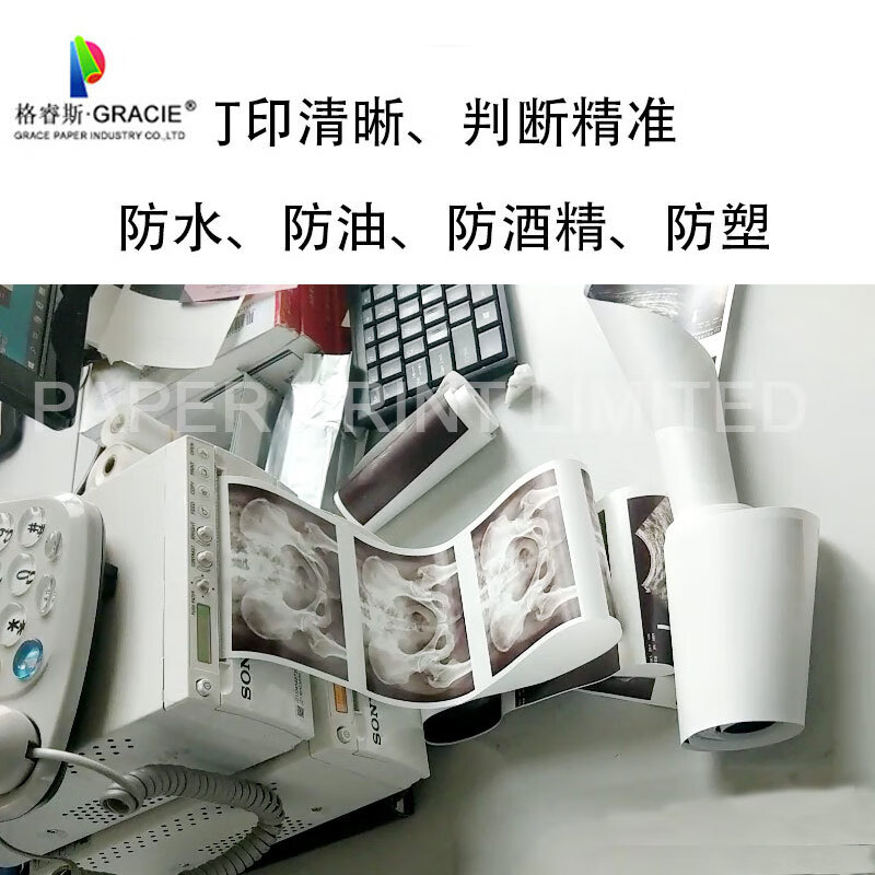 Compatible with UPP-110HGUPP-110SUPP-110HD video B-ultrasound thermal printing paper. Partially customized 1 roll UPP-110HG 110mmX18m Sony/