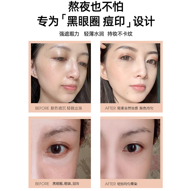 CIDE Light Control Concealer Moisturizing Concealer Foundation Cream Covers Freckles, Acne Scars, Dark Circles Birthmarks Blue Box RC140 Natural Color