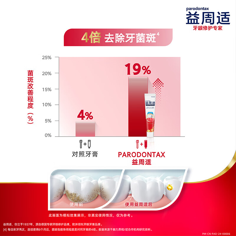 Yizhoushi Fresh Gum Care Toothpaste 110g*3 Spearmint type lasting freshness removes oral odor bacteria