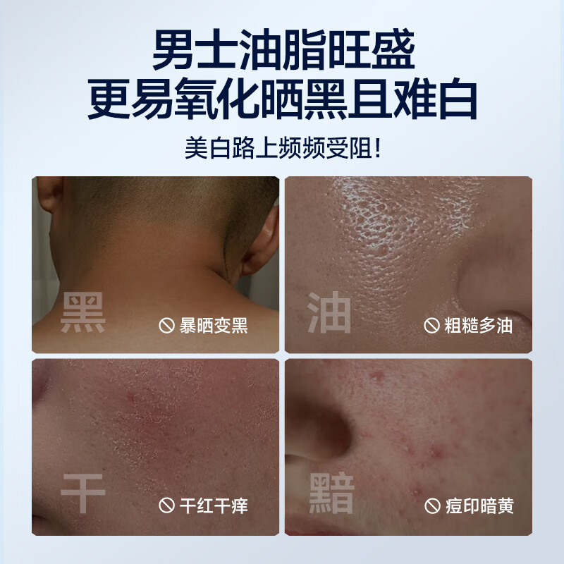 Zunlan 377 whitening and moisturizing cream, hydrating, anti-freckle cream, brightening and removing yellowing and dullness lotion, men's skin care products gift 100g