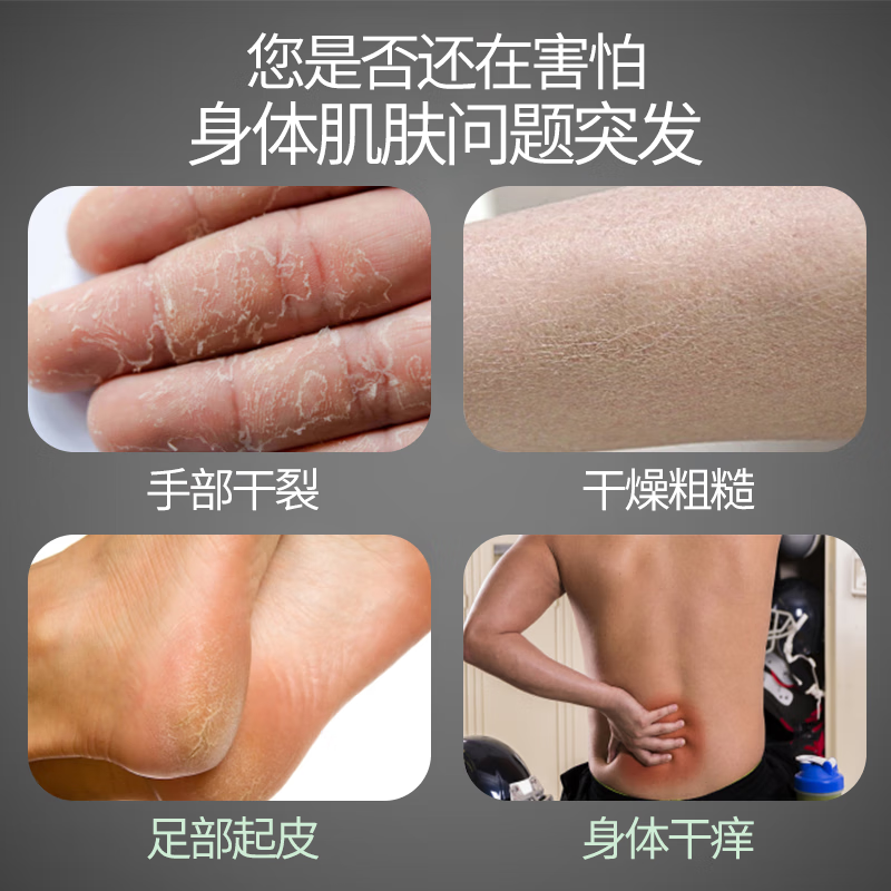 Sakose Vaseline men's fruit acid moisturizing body lotion 500ml autumn and winter hydrating moisturizing dry skin fragrance moisturizing lotion