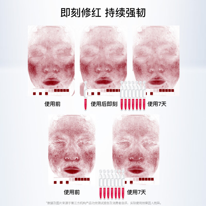 Pofuyan Soothing Repair Second-Pulse Essence 5 bottles Sensitive skin barrier repair moisturizing anti-wrinkle firming