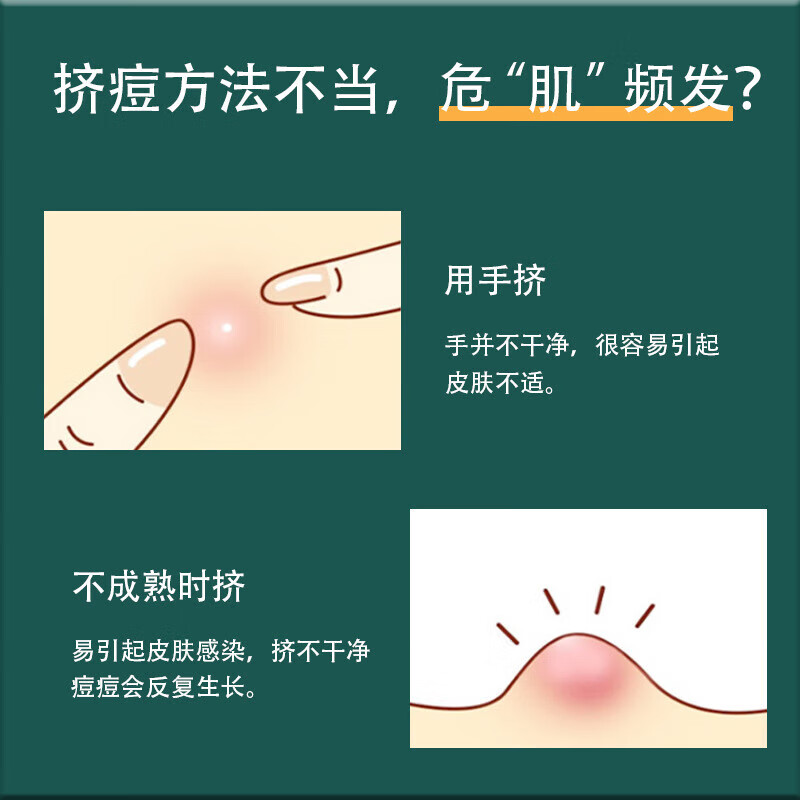 Visitor, acne needle, blackhead removal needle, pimple picking needle, blackhead removal, acne beauty needle, squeeze pimple picking, pimple cleaning artifact, scrape and close the mouth