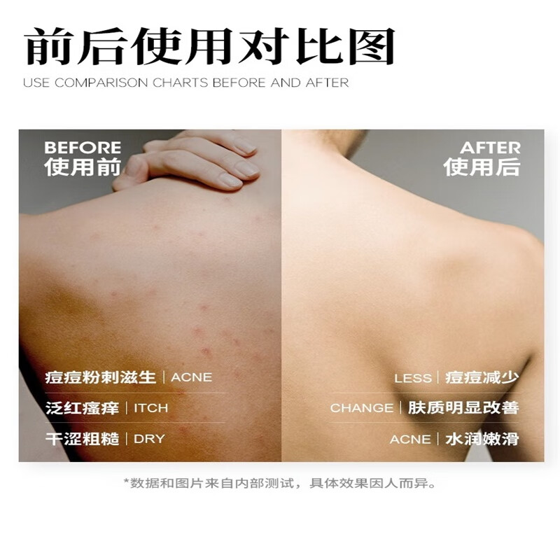 Silicone bath towel, back rub magic tool, strong mud rub without asking for help, bath brush, massage suction cup, foot rub pad, non-slip bath rub, whole body deep and refreshing rub, round silicone back rub pad - gray