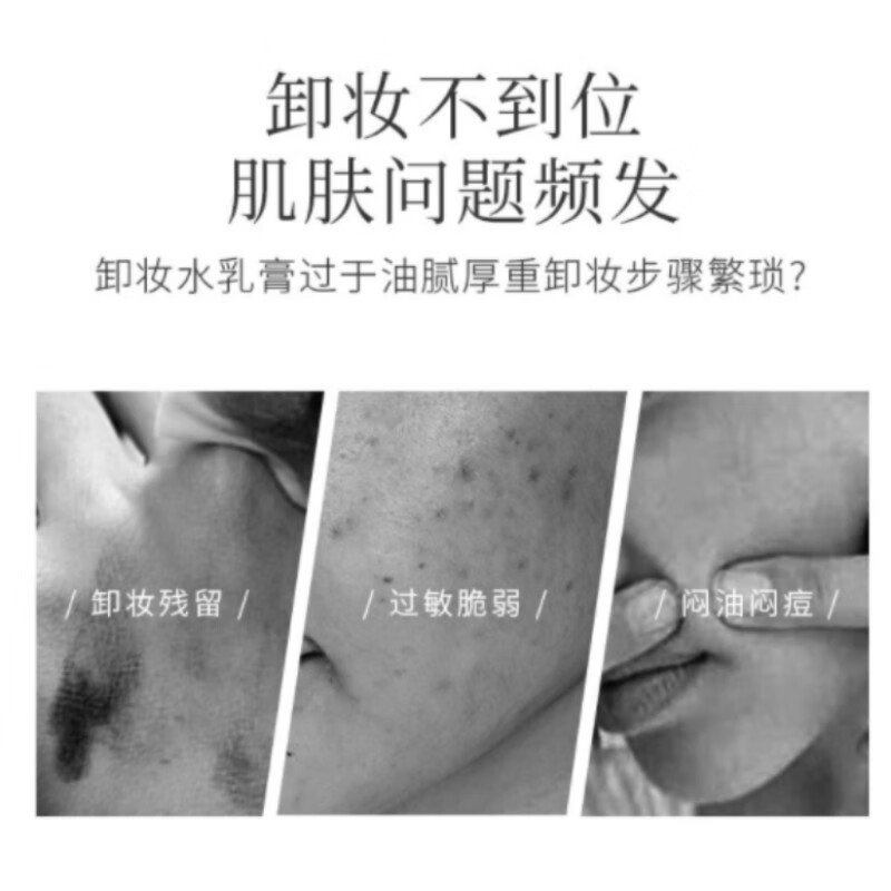 Kose makeup remover oil for eyes, lips, and face, wet and dry, non-greasy, deep cleansing, gentle, non-irritating makeup remover 60ml