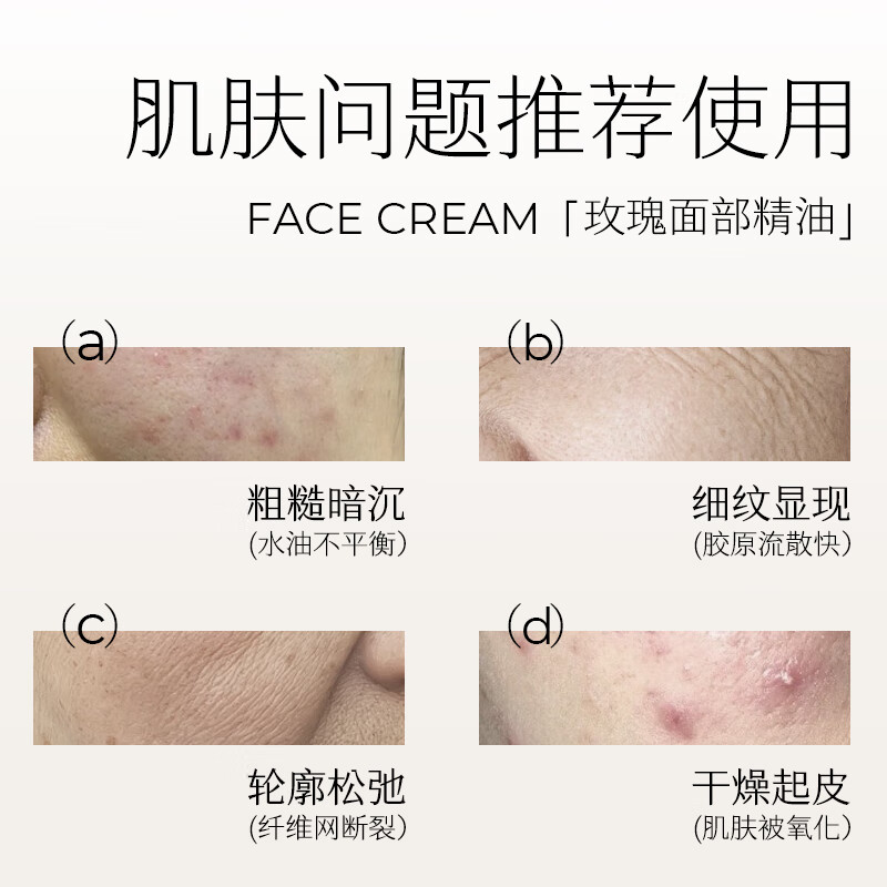 LANLVX British imported rose facial essential oil tightens, fine lines, moisturizing and anti-wrinkle essence to brighten skin tone