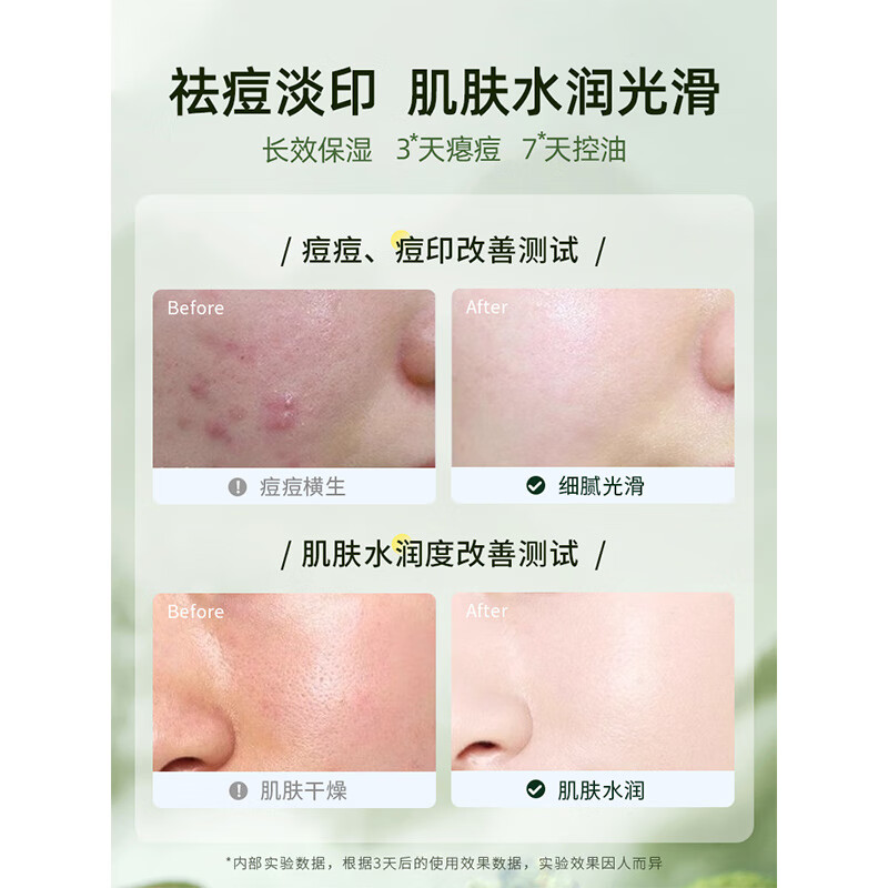 UNO facial cream 90g facial acne removal, oil control, hydrating and moisturizing men's acne removal face cream skin care Chinese Valentine's Day gift