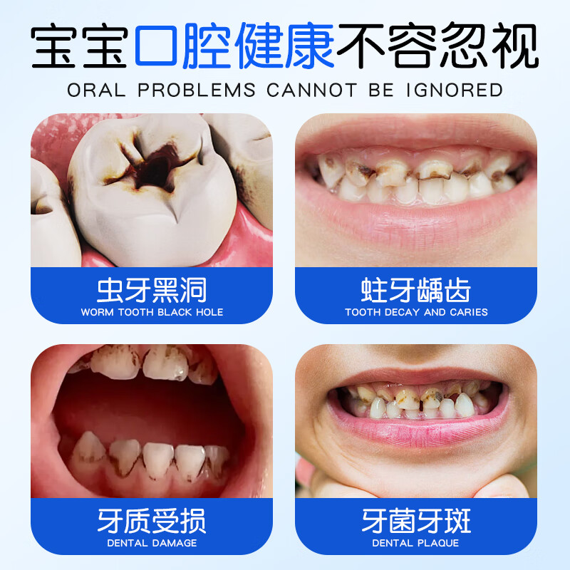 Post-medical children's toothpaste Oraflu 3-12 years old anti-cavity tooth protection 6-12 years old teeth yellow stains stains white teeth 200g