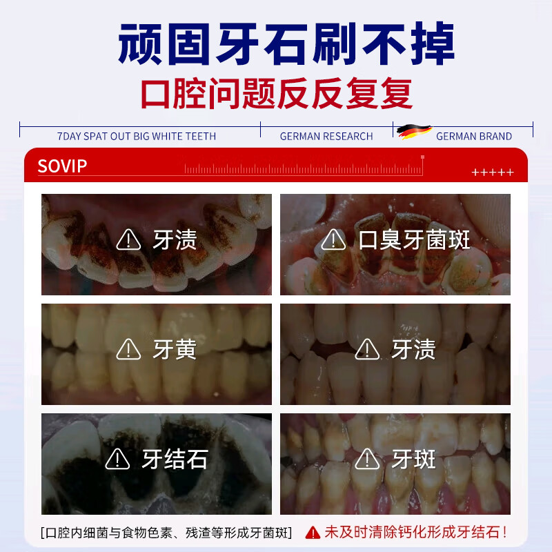 SOVIP German dental calculus cleaning artifact, antibacterial, remove bad breath, remove dental calculus, remove yellow, remove tobacco stains, remove tartar, non-mouthwash