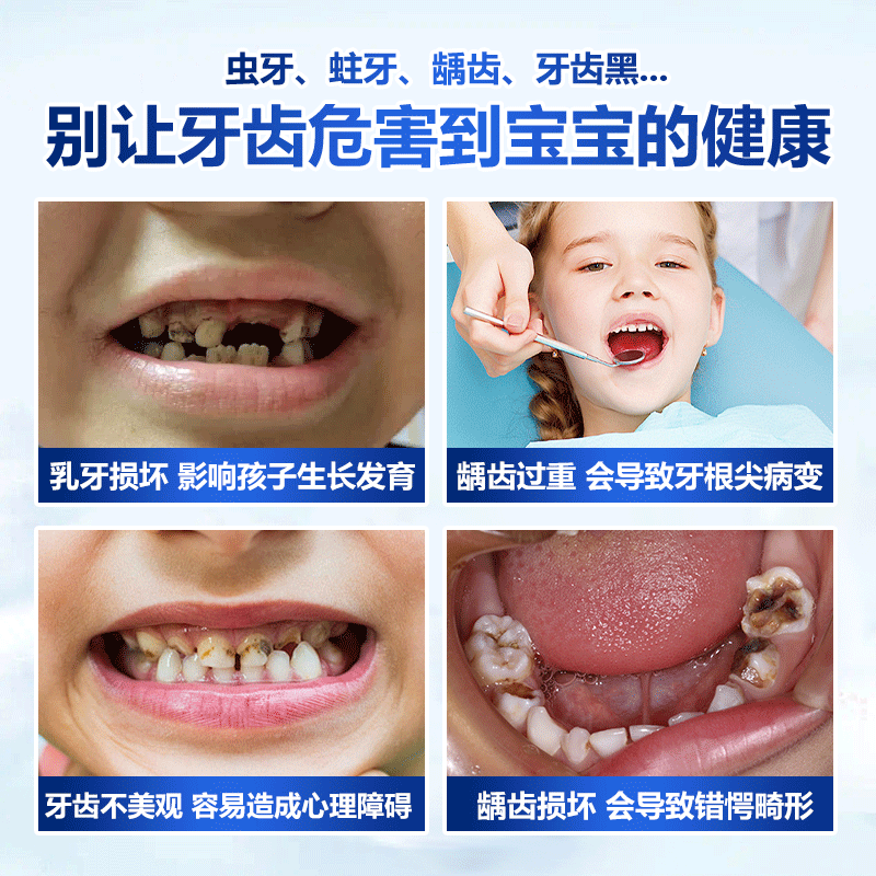 SOAO children's toothpaste 3-12 years old containing fluoride to prevent cavities Ora fluoride children's toothpaste gum care remove stains fresh breath 60g