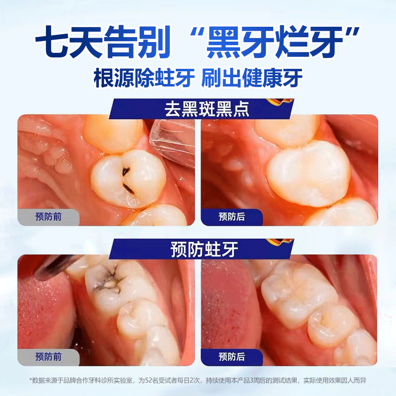 SOAO children's toothpaste 3-12 years old containing fluoride to prevent cavities Ora fluoride children's toothpaste gum care remove stains fresh breath 60g