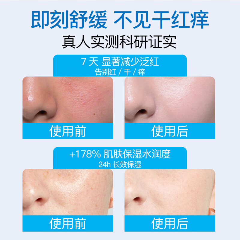 Sakose Vaseline B5 Moisturizing and Soothing Men's Face Cream 80g Moisturizing Oil Control Redness Anti-Cracking and Dry Skin Care Products