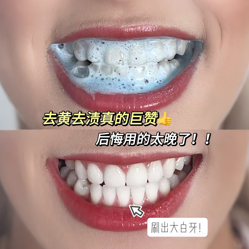 Sofa Color Repair Whitening Toothpaste Toothbrush Remove Yellow Stains Fresh Breath Antibacterial Remove Bad Breath Student Men and Women Family Pack 120g